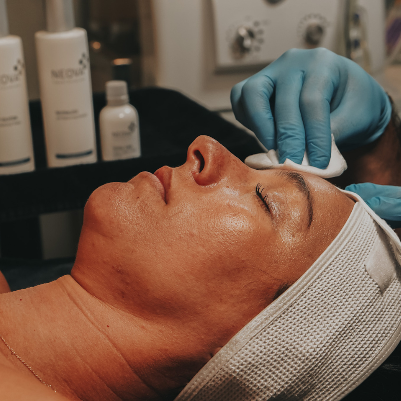 Chemical Peels, a Dr is cleaning dace of a women by using chemical peels
