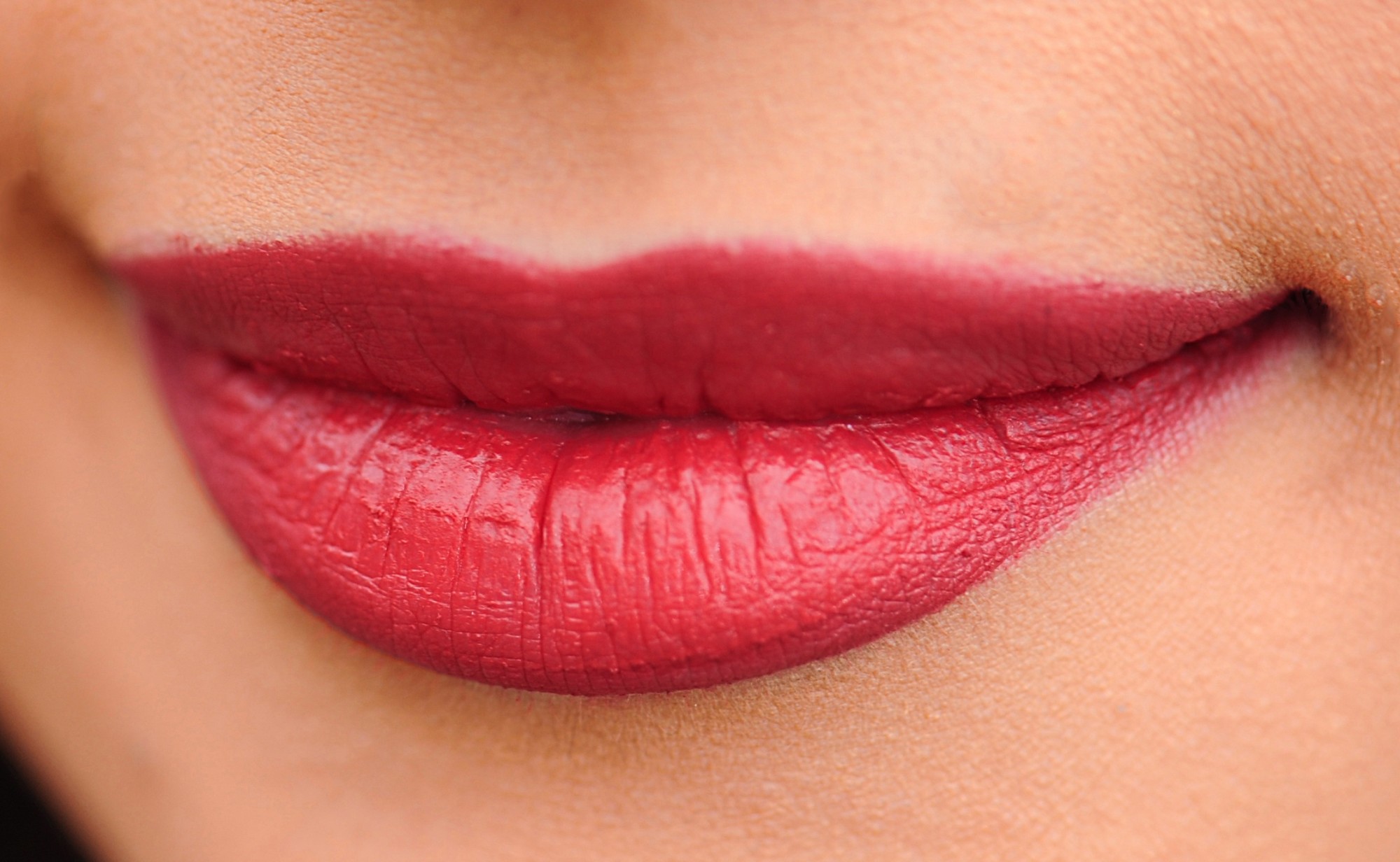 5 Things You Should Know About Lip Enhancement Treatments