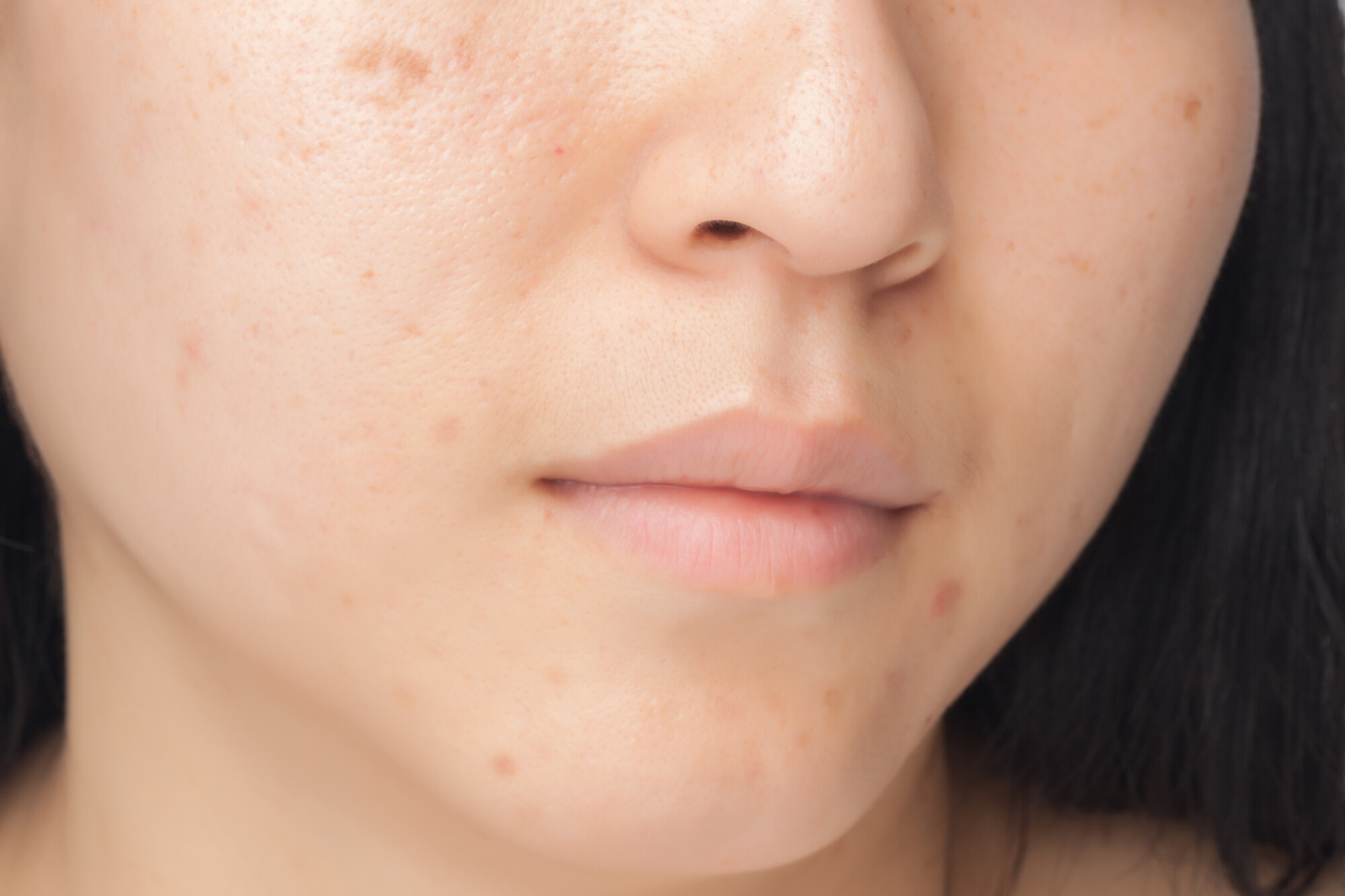 What Are the Different Causes of Damaged Skin?